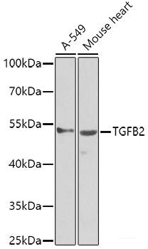 Immunofluorescence analysis of U2OS cells using GOSR1 Polyclonal Antibody at dilution of 1:100. Blue: DAPI for nuclear staining.