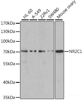 Immunohistochemistry of paraffin-embedded Human prostate cancer using ASIP Polyclonal Antibody at dilution of 1:100 (40x lens).