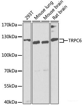 Western blot analysis of extracts of HeLa cells using IQGAP3 Polyclonal Antibody at dilution of 1:1000.