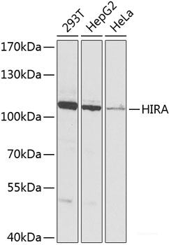 Immunohistochemistry of paraffin-embedded Rat spinal cord using HDGFRP3 Polyclonal Antibody at dilution of 1:100 (40x lens).