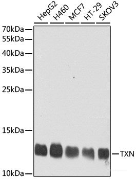 Immunohistochemistry of paraffin-embedded Human liver damage using DARS2 Polyclonal Antibody at dilution of 1:100 (40x lens).