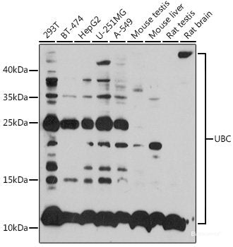 Immunofluorescence analysis of C6 cells using HMGCS1 Polyclonal Antibody at dilution of 1:100 (40x lens). Blue: DAPI for nuclear staining.