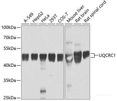 Western blot analysis of extracts of various cell lines using RPL13 Polyclonal Antibody at dilution of 1:1000.