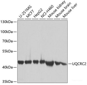 Western blot analysis of extracts of various cell lines using CBR4 Polyclonal Antibody at dilution of 1:1000.