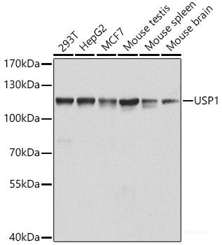 Immunohistochemistry of paraffin-embedded Human colon carcinoma using SS18 Polyclonal Antibody at dilution of 1:200 (40x lens).