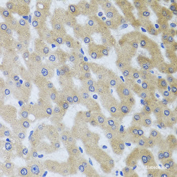 Immunohistochemistry of paraffin-embedded Mouse brain using SS18L1 Polyclonal Antibody at dilution of 1:100 (40x lens).