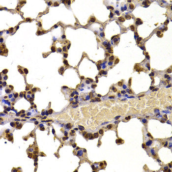 Immunofluorescence analysis of U2OS cells using CDK16 Polyclonal Antibody at dilution of 1:100. Blue: DAPI for nuclear staining.
