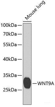 Immunohistochemistry of paraffin-embedded Human stomach using PLCB2 Polyclonal Antibody at dilution of 1:100 (40x lens).