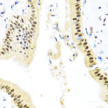 Western blot analysis of extracts of Mouse small intestine using PMP2 Polyclonal Antibody at dilution of 1:1000.