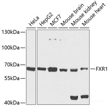 Western blot analysis of extracts of various cell lines using BNIP2 Polyclonal Antibody at dilution of 1:1000.