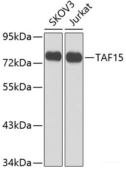 Western blot analysis of extracts of Rat testis using PTPRS Polyclonal Antibody at dilution of 1:3000.