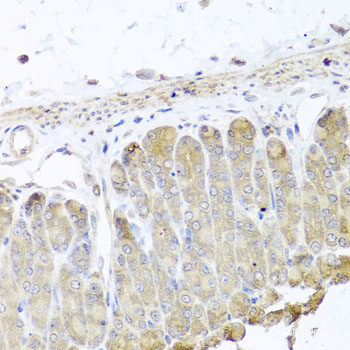 Immunofluorescence analysis of U2OS cells using ABCE1 Polyclonal Antibody at dilution of 1:100. Blue: DAPI for nuclear staining.