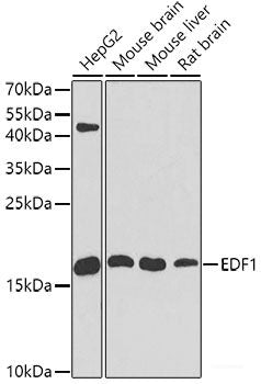 Western blot analysis of extracts of HepG2 cells using PRKG1 Polyclonal Antibody at dilution of 1:1000.