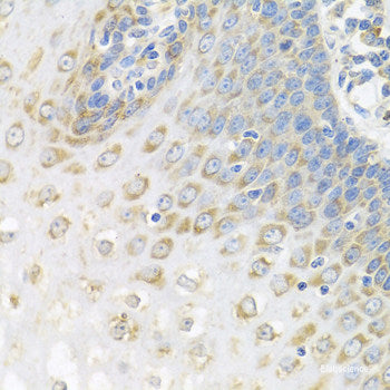 Immunohistochemistry of paraffin-embedded Rat brain using BTD Polyclonal Antibody at dilution of 1:100 (40x lens).