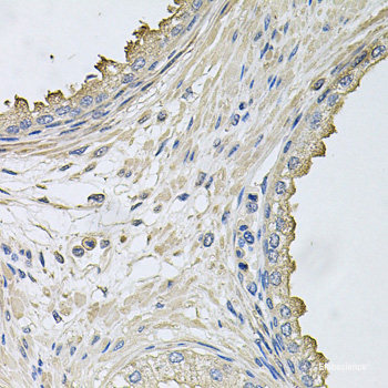 Immunofluorescence analysis of U-2 OS cells using PHLPP1 Polyclonal Antibody at dilution of 1:100 (40x lens). Blue: DAPI for nuclear staining.
