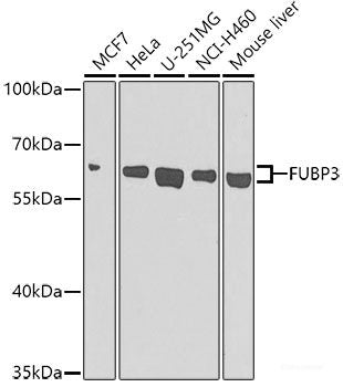 Western blot analysis of extracts of Mouse brain using FBXW4 Polyclonal Antibody at dilution of 1:1000.