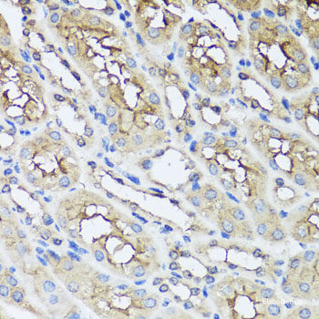 Western blot analysis of extracts of various cell lines using Phospho-NFKB1(S337) Polyclonal Antibody at dilution of 1:1000. HeLa cells were treated by TNF-α (20 ng/ml) and Calyculin A (100 nM) at 37°C for 10 minutes. C6 cells were treated by TNF-α (20 ng/ml) at 37°C for 10 minutes.