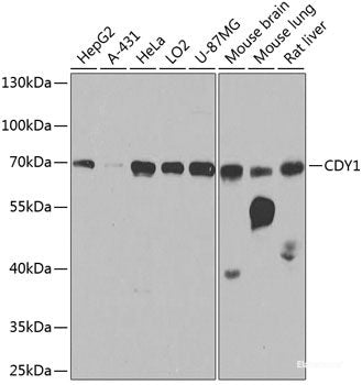 Western blot analysis of extracts from NIH/3T3 using Phospho-AKT(S473) Polyclonal Antibody.