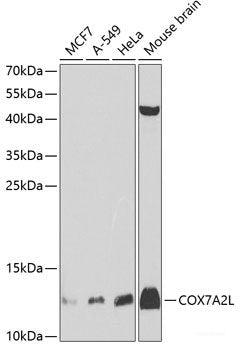 Immunohistochemistry of paraffin-embedded Mouse kidney using SYNPO Polyclonal Antibody at dilution of 1:100 (40x lens).