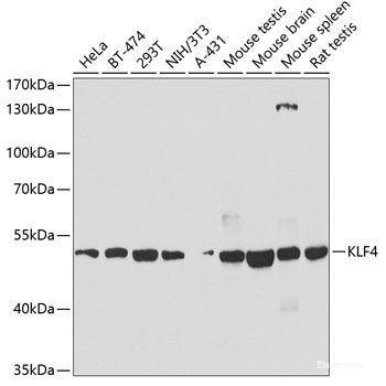 Immunofluorescence analysis of U-2 OS cells using ZBED1 Polyclonal Antibody at dilution of 1:100. Blue: DAPI for nuclear staining.