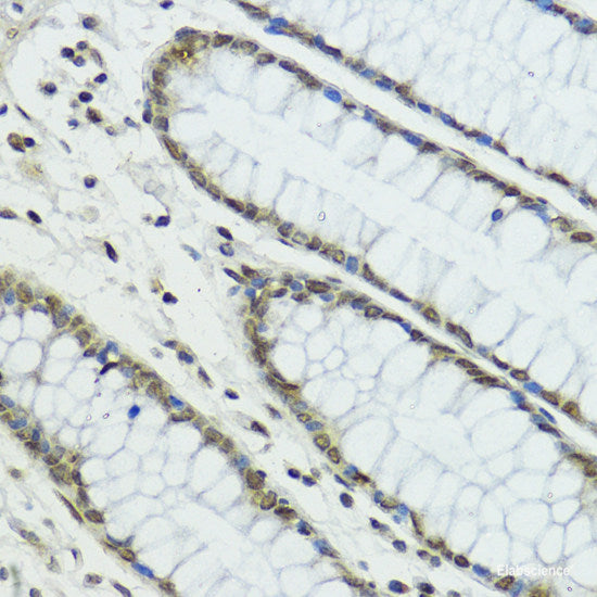Western blot analysis of extracts from HeLa cells using Phospho-HNF4A(S304) Polyclonal Antibody.