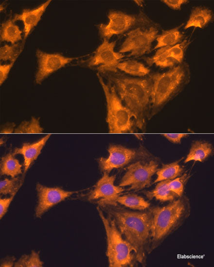 Immunofluorescence analysis of Hela cells using GSTK1 Polyclonal Antibody at dilution of 1:100 (40x lens). Blue: DAPI for nuclear staining.