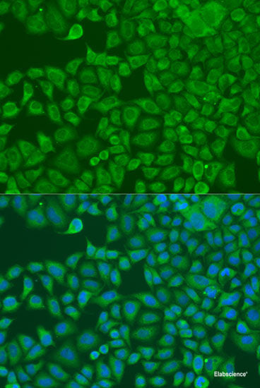 Immunohistochemistry of paraffin-embedded Human breast using Snail Polyclonal Antibody at dilution of 1:100 (40x lens).