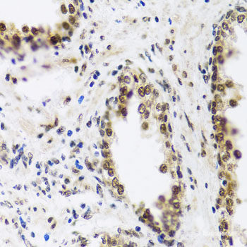 Immunohistochemistry of paraffin-embedded Rat spleen using TLR4 Polyclonal Antibody at dilution of 1:100 (40x lens).