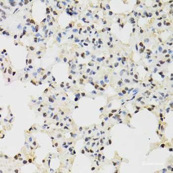 Western blot analysis of extracts of Mouse liver using SULT1C2 Polyclonal Antibody at dilution of 1:1000.