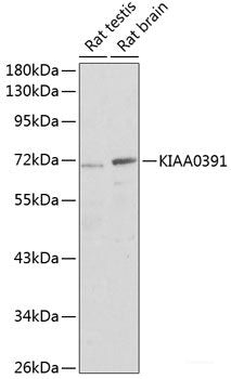 Western blot analysis of extracts of various cell lines using SSX5 Polyclonal Antibody at dilution of 1:1000.