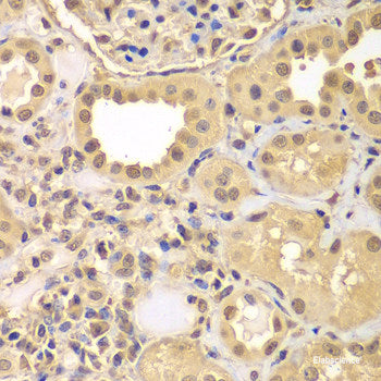 Immunohistochemistry of paraffin-embedded Rat lung using LLGL2 Polyclonal Antibody at dilution of 1:200 (40x lens).