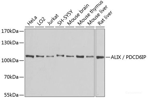 Immunohistochemistry of paraffin-embedded Human colon using RANKL Polyclonal Antibody at dilution of 1:100 (40x lens).