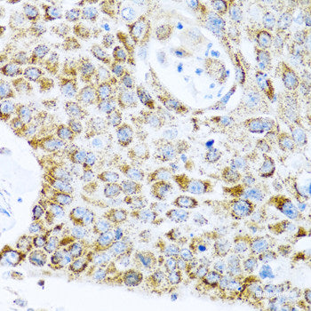 Immunohistochemistry of paraffin-embedded Human esophagus using STAU1 Polyclonal Antibody at dilution of 1:100 (40x lens).