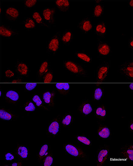 Western blot analysis of extracts of Mouse lung using SRSF2 Polyclonal Antibody at dilution of 1:1000.