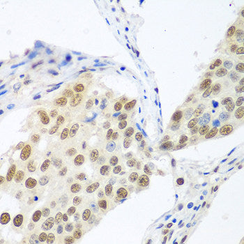 Immunofluorescence analysis of A549 cells using APOD Polyclonal Antibody
