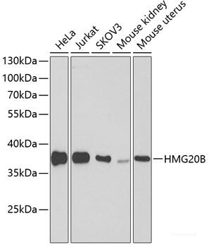 Immunofluorescence analysis of U2OS cells using RACGAP1 Polyclonal Antibody