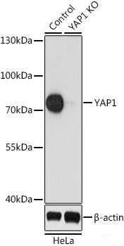 Western blot analysis of extracts of various cell lines using PCBP1 Polyclonal Antibody at dilution of 1:1000.