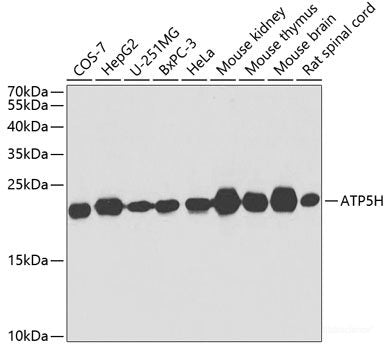 Immunohistochemistry of paraffin-embedded Rat spleen using AIMP1 Polyclonal Antibody at dilution of 1:100 (40x lens).
