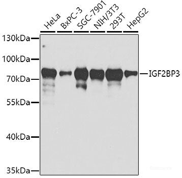 Western blot analysis of extracts of various cell lines using Asymmetric DiMethyl-Histone H3-R2 Polyclonal Antibody at dilution of 1:1000.