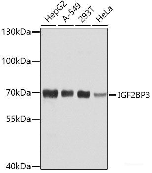 Western blot analysis of extracts of Rat liver using FABP1 Polyclonal Antibody at dilution of 1:1000.