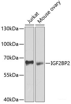 Western blot analysis of extracts of various cell lines using MonoMethyl-Histone H3-R2 Polyclonal Antibody.