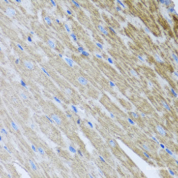 Immunohistochemistry of paraffin-embedded Human liver using UCHL3 Polyclonal Antibody at dilution of 1:100 (40x lens).