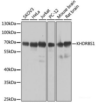 Western blot analysis of extracts of HeLa cells using ALPP Polyclonal Antibody at dilution of 1:1000.