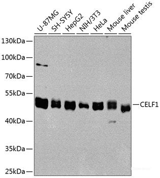 Immunohistochemistry of paraffin-embedded Rat heart using SCARB2 Polyclonal Antibody at dilution of 1:100 (20x lens).