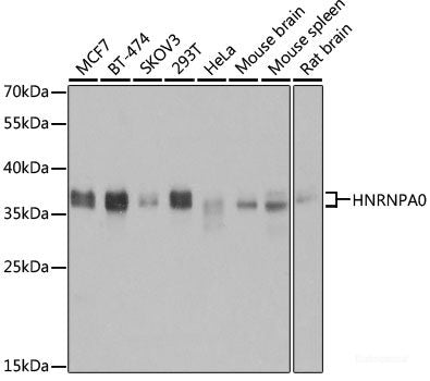 Immunofluorescence analysis of HeLa cells using ST3GAL4 Polyclonal Antibody