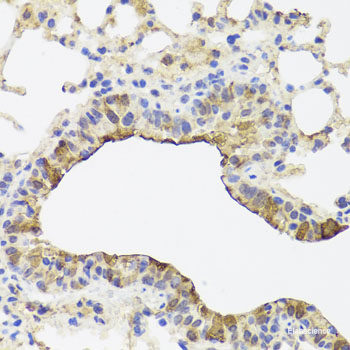 Immunohistochemistry of paraffin-embedded Rat lung using GTF2H2 Polyclonal Antibody at dilution of 1:100 (40x lens).