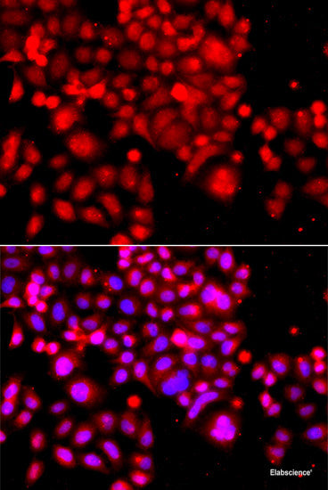 Western blot analysis of extracts of Rat liver using USF2 Polyclonal Antibody at dilution of 1:1000.