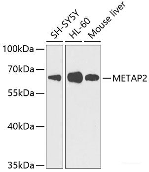 Western blot analysis of extracts of M21 cells using MLANA Polyclonal Antibody at dilution of 1:1000.