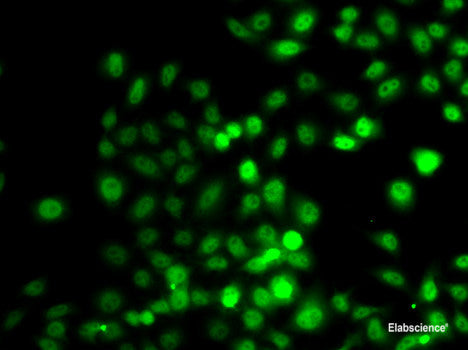 Immunohistochemistry of paraffin-embedded Human breast cancer using KDM6A Polyclonal Antibody at dilution of 1:200 (40x lens).