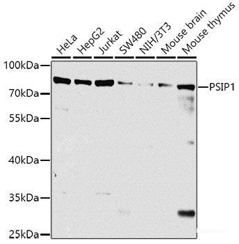 Immunofluorescence analysis of HeLa cells using ZFYVE9 Polyclonal Antibody at dilution of 1:100. Blue: DAPI for nuclear staining.